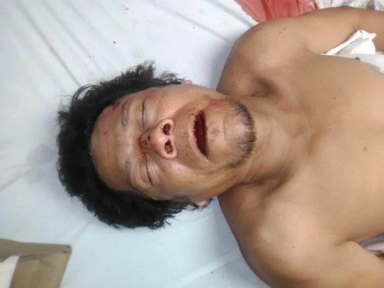 Ebrio en bicicleta cae y se descalabra