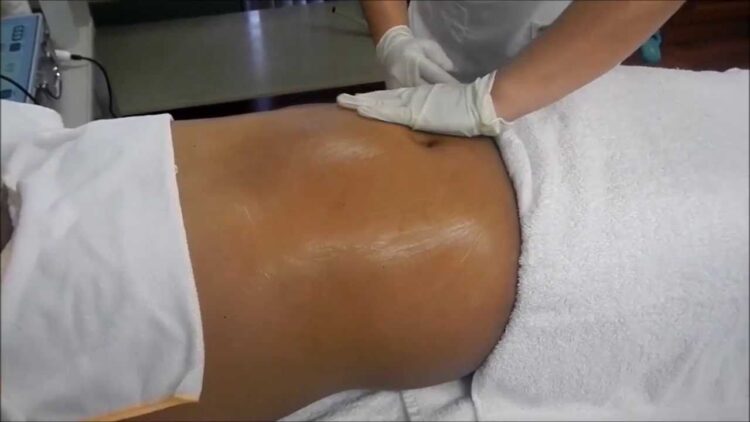 Muere joven tras realizarse “lipo” en clínica de Monterrey