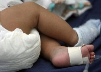 Padrastro le fractura a golpes piernas a bebé de 6 meses