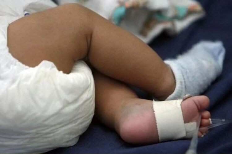 Padrastro le fractura a golpes piernas a bebé de 6 meses