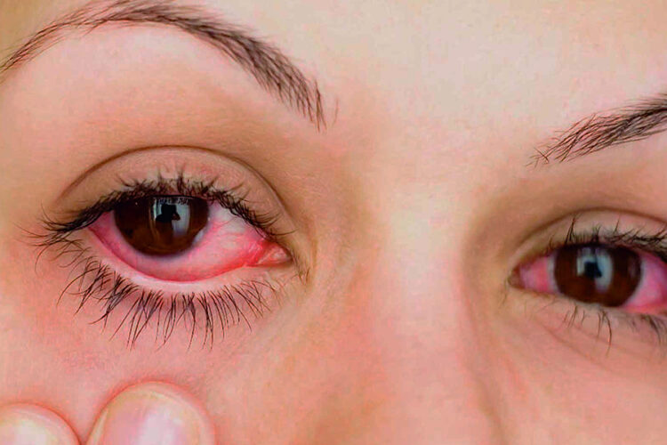 Alertan por riesgos a la salud visual ante fuertes rachas de viento y polvo
