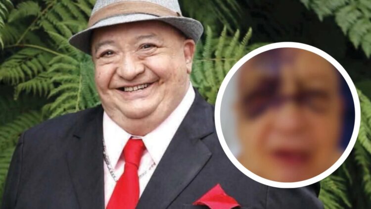 Luis de Alba, el Pirruris, preocupa tras accidente: esposa revela la verdad del desmayo y su estado de salud