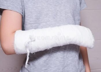 !Cuidado!… porque en vacaciones escolares aumentan accidentes caseros en menores